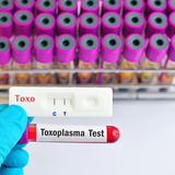 【医師監修】トキソプラズマ症とは？ 妊娠中に感染したときの症状とリスク