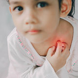 【医師監修】子供の湿疹・発疹 | 症状別考えられる病気と対処法