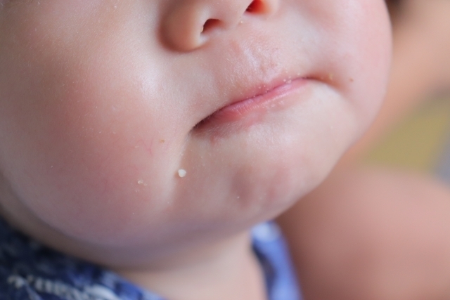医師監修 離乳食アレルギーで出る症状は 口の周りが赤い よだれかぶれとの見分け方は