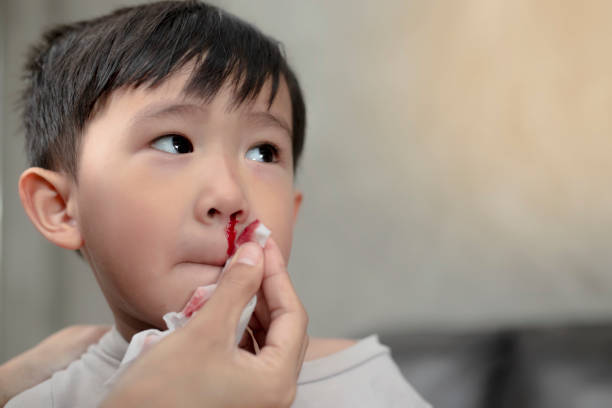医師解説 子供や赤ちゃんの鼻血 鼻出血 は何が原因 対処法とやってはいけないこと マイナビ子育て