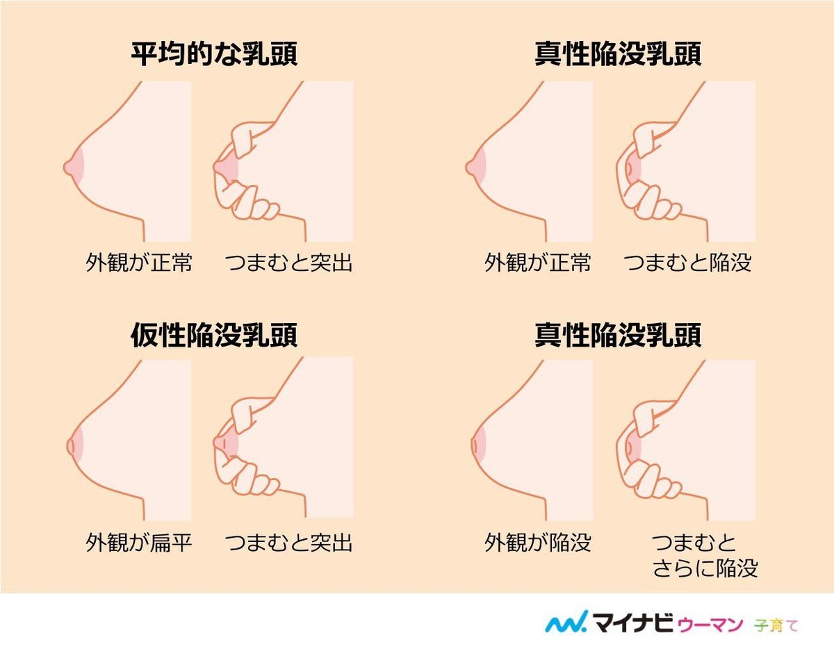 助産師監修 陥没乳頭 扁平乳頭で授乳はできる 自分でできる授乳のコツ