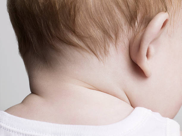 医師監修 赤ちゃんの首が臭い においの原因とただれがある場合の対処