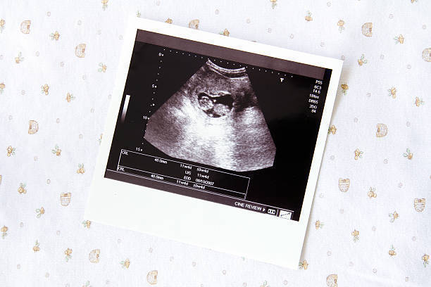 医師監修 妊娠7週のエコー写真 胎盤が作られ始めるころ