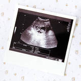 医師監修 妊娠27週のエコー写真 光を感じられるようになる マイナビ子育て