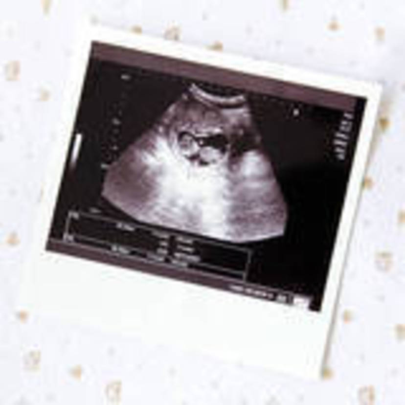 医師監修 妊娠28週のエコー写真 羊水の量が最大に近づいてくる マイナビ子育て