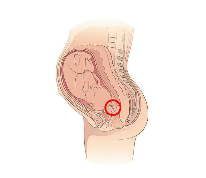 子宮 口 4 センチ 経産婦