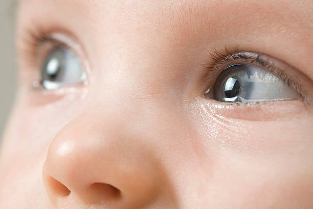 医師監修 赤ちゃんの目やにや涙が多いときに考えられる疾患は マイナビウーマン子育て 赤ちゃん の目元に目やにがいっぱいついてい ｄメニューニュース Nttドコモ