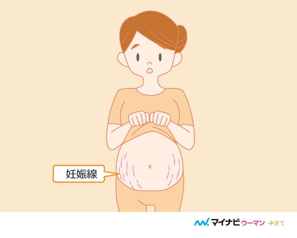 医師監修 妊婦さんのお腹はいつから出てくる お腹が膨らむ時期 目立つ時期 マイナビウーマン子育て