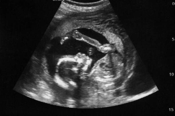 医師監修 胎児の大きさの調べ方は 測定方法と発育の目安 考えられるトラブル Michill ミチル
