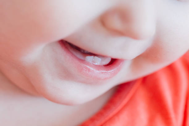 歯科医師監修 赤ちゃんの歯並びが気になる その要因とよくする方法 マイナビウーマン子育て Goo ニュース