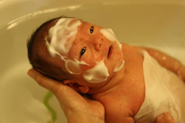 医師監修 赤ちゃんの頭にフケが 2つの原因と対処法 マイナビウーマン子育て 生後しばらくすると 赤ちゃん の頭皮にフケ ｄメニューニュース Nttドコモ