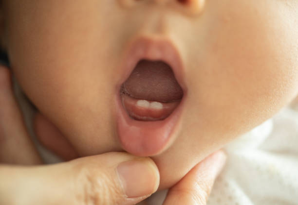 医師監修 赤ちゃんの歯ぐずりに効果的な3つの対処法 マイナビウーマン子育て Goo ニュース