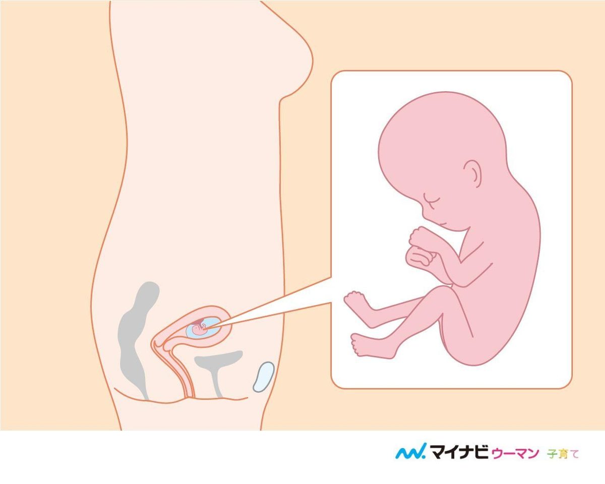医師監修 妊娠11週のエコー写真を多数掲載 みんなのエピソードつき マイナビウーマン子育て Goo ニュース