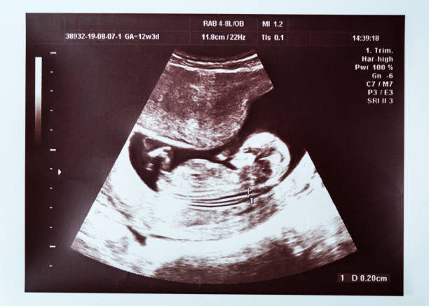 医師監修 ベビーナブで胎児の性別がわかる 見分け方や正確性について マイナビウーマン子育て