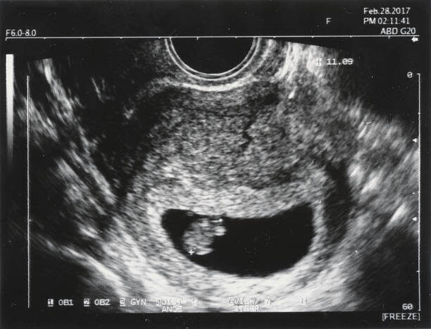 だいたひかるさん エコー写真で夫と口論 胎児の脚が長い お腹の子は 順調 元気 21年7月29日 Biglobeニュース